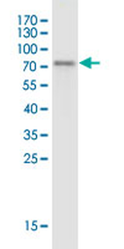 ERCC2 monoclonal antibody (M01J), clone 4G2-2A6
