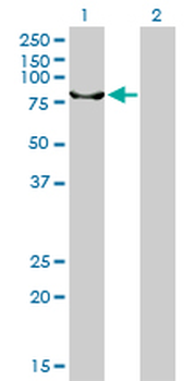 ERCC2 monoclonal antibody (M01), clone 4G2-2A6