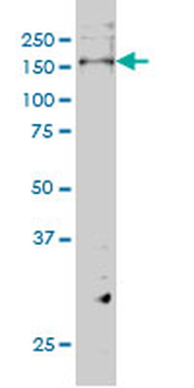 ERBB3 monoclonal antibody (M01), clone 2E9