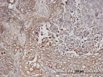 ERBB3 monoclonal antibody (M01), clone 2E9