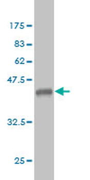 ERBB3 monoclonal antibody (M01), clone 2E9
