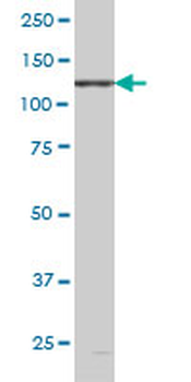 EPHB6 monoclonal antibody (M03), clone 5D8