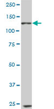 EPHB6 monoclonal antibody (M03), clone 5D8