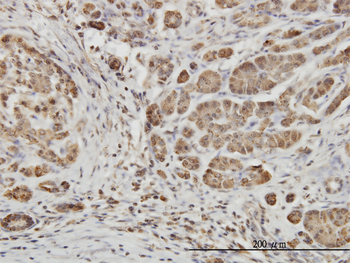 EPHB6 monoclonal antibody (M03), clone 5D8