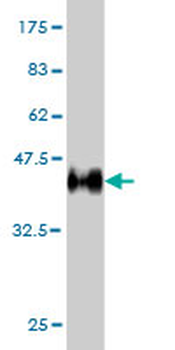 EPHB6 monoclonal antibody (M03), clone 5D8