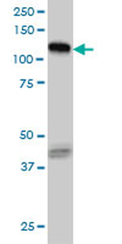 EPHB3 monoclonal antibody (M01), clone 1B3