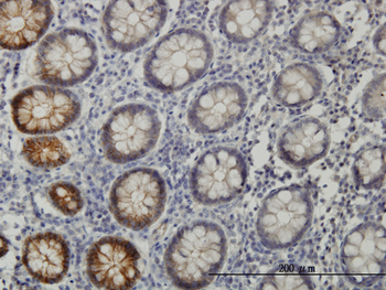 EPHB3 monoclonal antibody (M01), clone 1B3