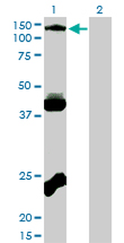 EPHB3 monoclonal antibody (M01), clone 1B3