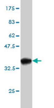 EPHB3 monoclonal antibody (M01), clone 1B3