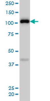 EPHA4 monoclonal antibody (M02), clone 6H7