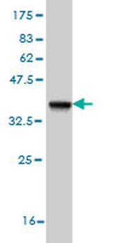EPHA4 monoclonal antibody (M02), clone 6H7