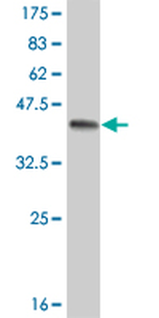 EPHA3 monoclonal antibody (M02), clone 3E9