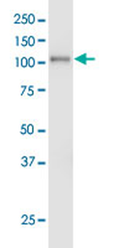 EPHA3 monoclonal antibody (M01), clone 3A12