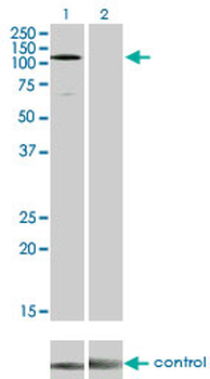 EPHA3 monoclonal antibody (M01), clone 3A12