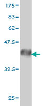 EPHA3 monoclonal antibody (M01), clone 3A12