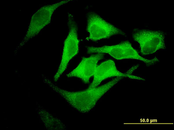 EPB42 monoclonal antibody (M01), clone 2G12