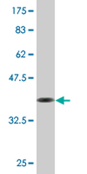 EPB42 monoclonal antibody (M01), clone 2G12