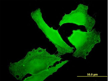 EPB41 monoclonal antibody (M01), clone 3D9