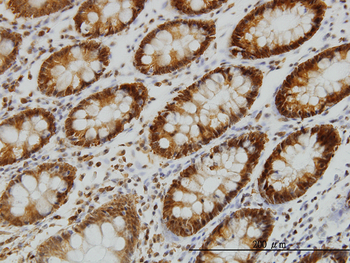 EPB41 monoclonal antibody (M01), clone 3D9