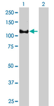 EPB41 monoclonal antibody (M01), clone 3D9