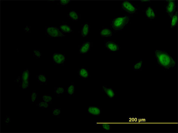 EP300 monoclonal antibody (M02), clone 1D2