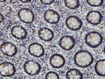 EP300 monoclonal antibody (M02), clone 1D2
