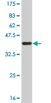 EP300 monoclonal antibody (M02), clone 1D2