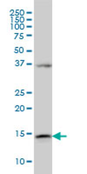 ENSA monoclonal antibody (M02), clone 1H7
