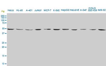 ENO2 monoclonal antibody (M01), clone 1A3