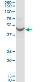 ENO1 polyclonal antibody (A01)