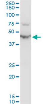 ENO1 polyclonal antibody (A01)