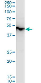 ENO1 polyclonal antibody (A01)