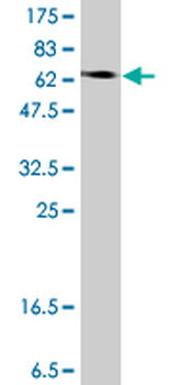 ENO1 polyclonal antibody (A01)