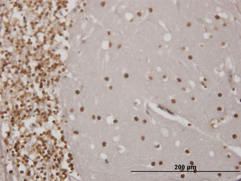 EN1 monoclonal antibody (M04), clone 3H2