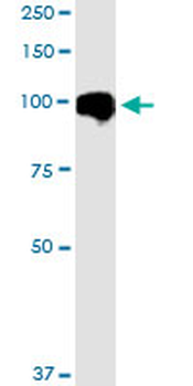 MARK2 monoclonal antibody (M01), clone 3B12