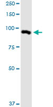 MARK2 monoclonal antibody (M01), clone 3B12