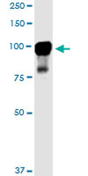 MARK2 monoclonal antibody (M01), clone 3B12