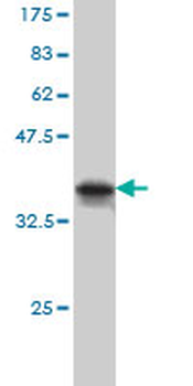 MARK2 monoclonal antibody (M01), clone 3B12