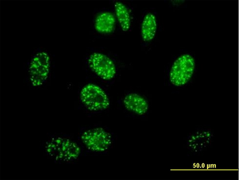 ELK4 purified MaxPab mouse polyclonal antibody (B01P)
