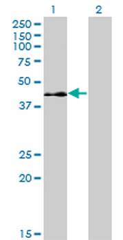 ELK3 monoclonal antibody (M02), clone 3A12