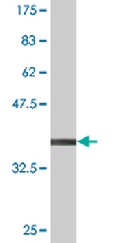 ELK3 monoclonal antibody (M02), clone 3A12