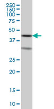 ELF3 monoclonal antibody (M02), clone 2B11