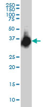 ELAVL4 monoclonal antibody (M01), clone 6B9