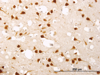 ELAVL4 monoclonal antibody (M01), clone 6B9