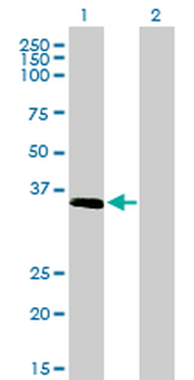 ELAVL4 monoclonal antibody (M01), clone 6B9