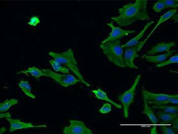 SERPINB1 monoclonal antibody (M02), clone 4D7