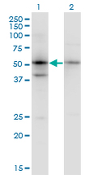 SERPINB1 monoclonal antibody (M02), clone 4D7
