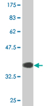 SERPINB1 monoclonal antibody (M02), clone 4D7