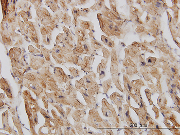 EIF4G2 monoclonal antibody (M01), clone 3B5