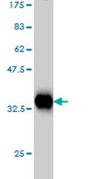 EIF4G2 monoclonal antibody (M01), clone 3B5